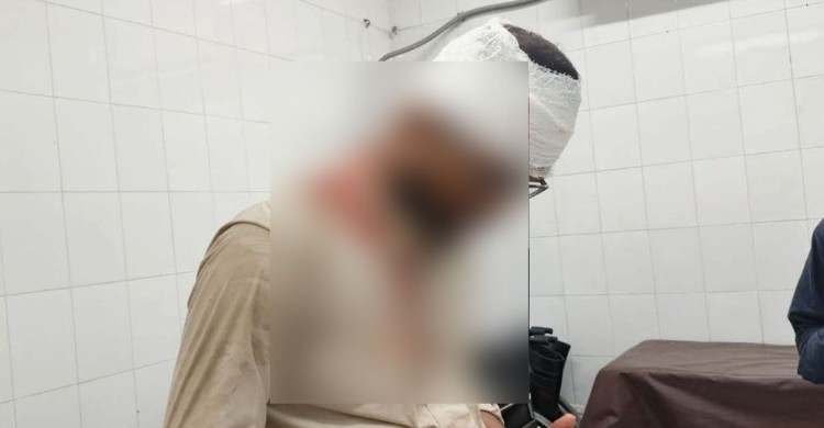 আবারও জকসু নেতার ওপর হামলা